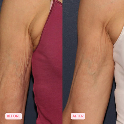 Pureglowskin™ Sculpt & Tone Arm Cream