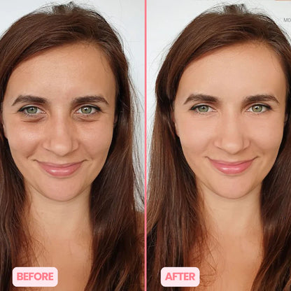 MicroGlow Eye Patches