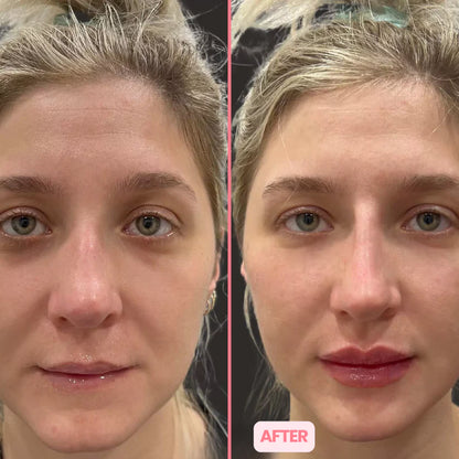 MicroGlow Eye Patches