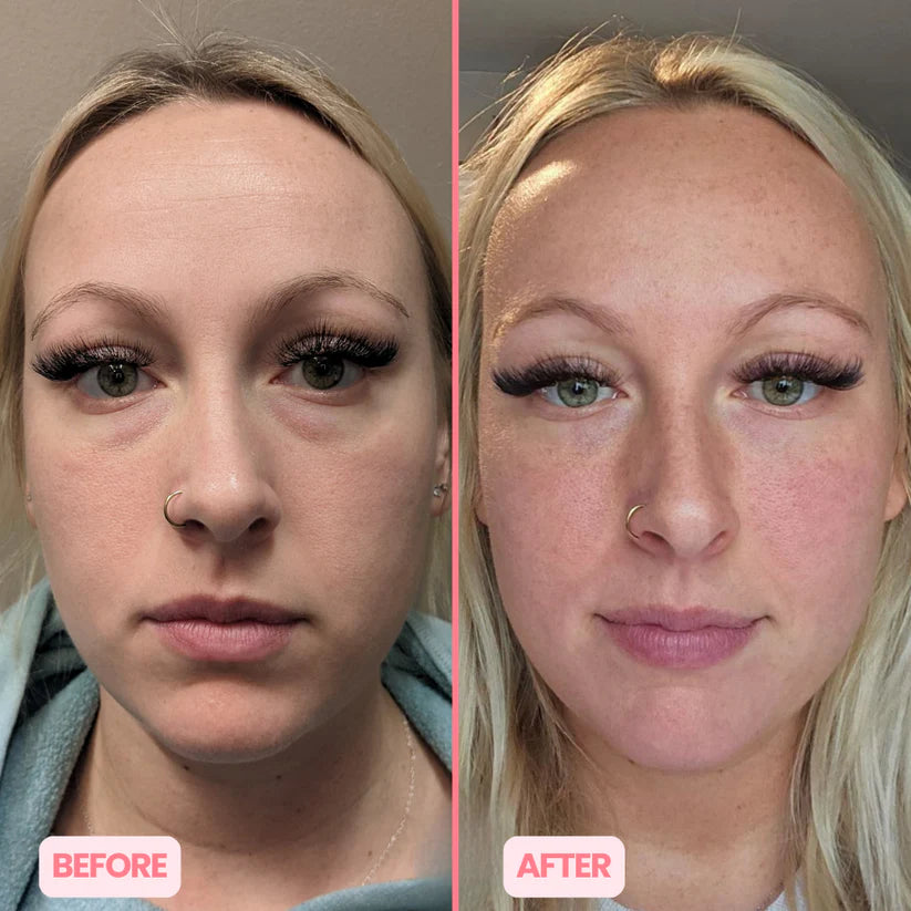 MicroGlow Eye Patches