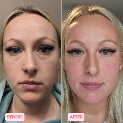 MicroGlow Eye Patches