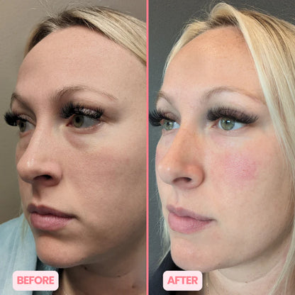 MicroGlow Eye Patches