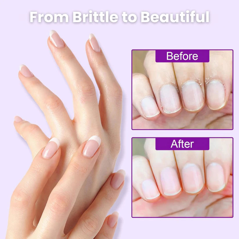 Stem Infusion Oil - Buy 1 Get 3 Free