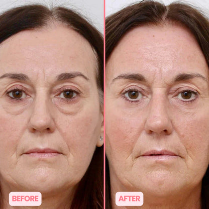 MicroGlow Eye Patches