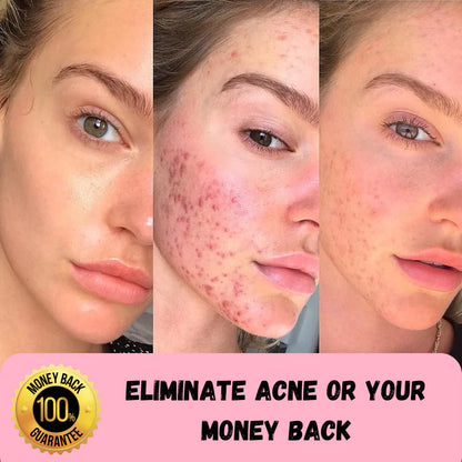 DermaWand 2.0 - 4 in 1 High Frequency Wand